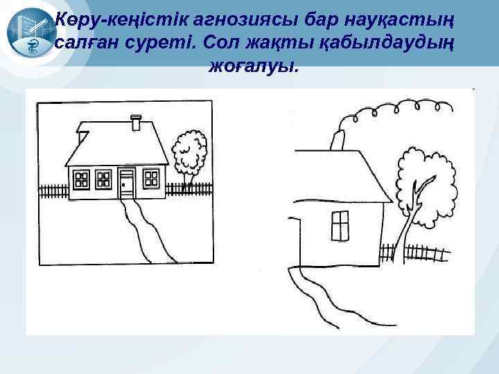 Көру-кеңістік агнозиясы бар науқастың салған суреті. Сол жақты қабылдаудың жоғалуы. 