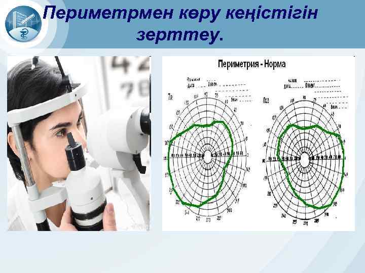 Периметрия в офтальмологии