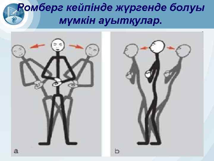 Ромберг кейпінде жүргенде болуы мүмкін ауытқулар. 