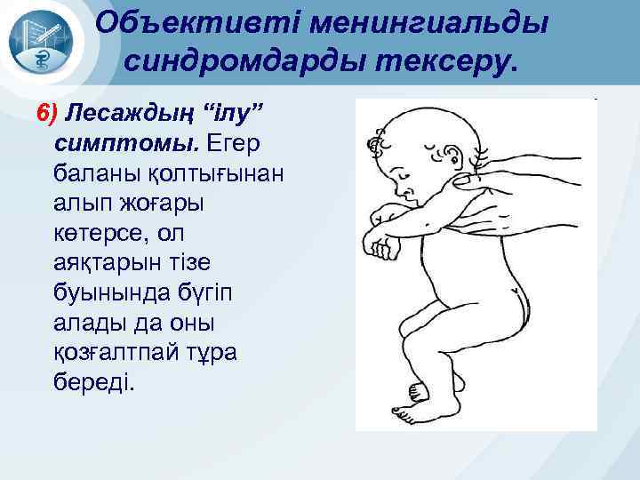 Объективті менингиальды синдромдарды тексеру. 6) Лесаждың “ілу” симптомы. Егер баланы қолтығынан алып жоғары көтерсе,