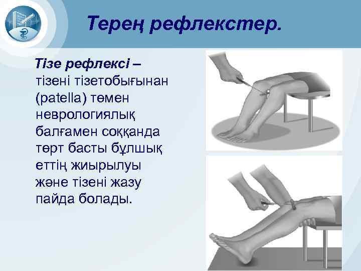 Терең рефлекстер. Тізе рефлексі – тізені тізетобығынан (patella) төмен неврологиялық балғамен соққанда төрт басты