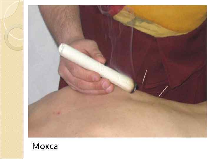 Мокса 