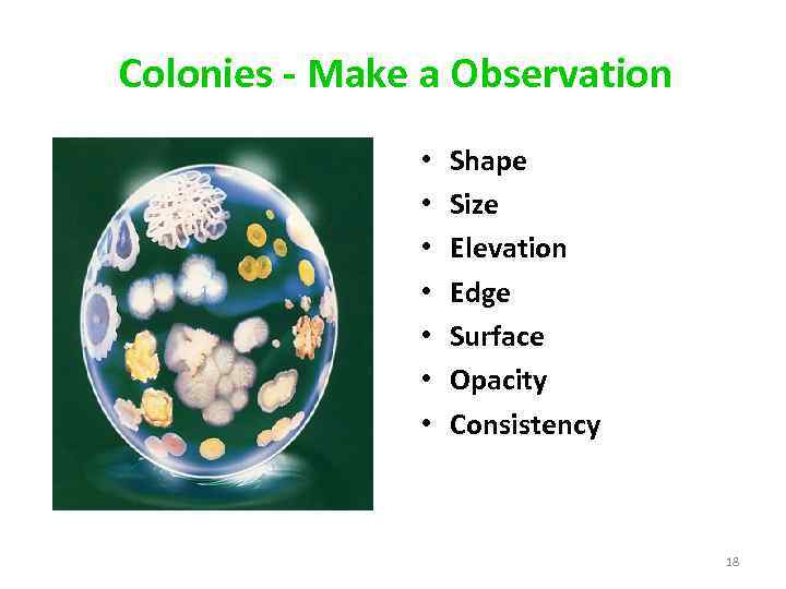 Colonies - Make a Observation • • Shape Size Elevation Edge Surface Opacity Consistency