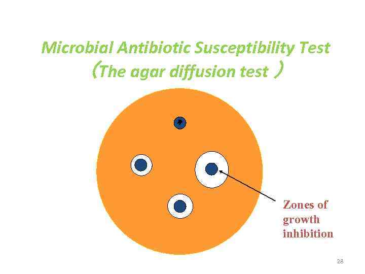 Microbial Antibiotic Susceptibility Test （The agar diffusion test ） Zones of growth inhibition 28