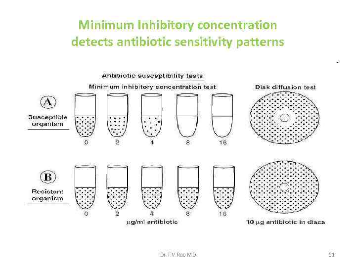 Minimum Inhibitory concentration detects antibiotic sensitivity patterns Dr. T. V. Rao MD 31 