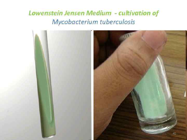 Lowenstein Jensen Medium - cultivation of Mycobacterium tuberculosis 40 