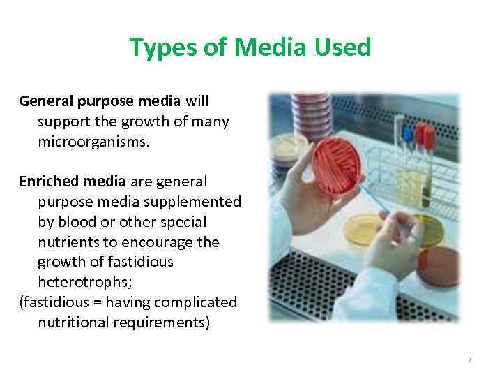 what are the 3 types of bacterial culture media