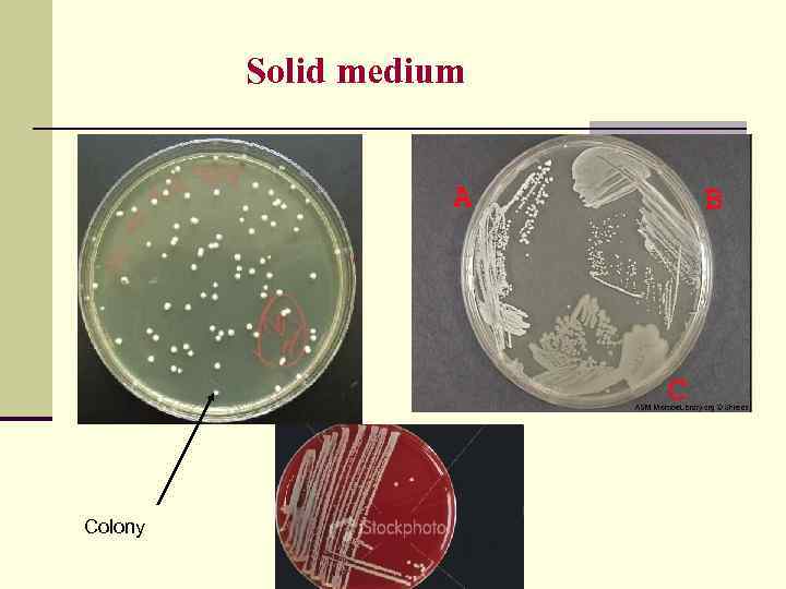 Solid medium Colony 