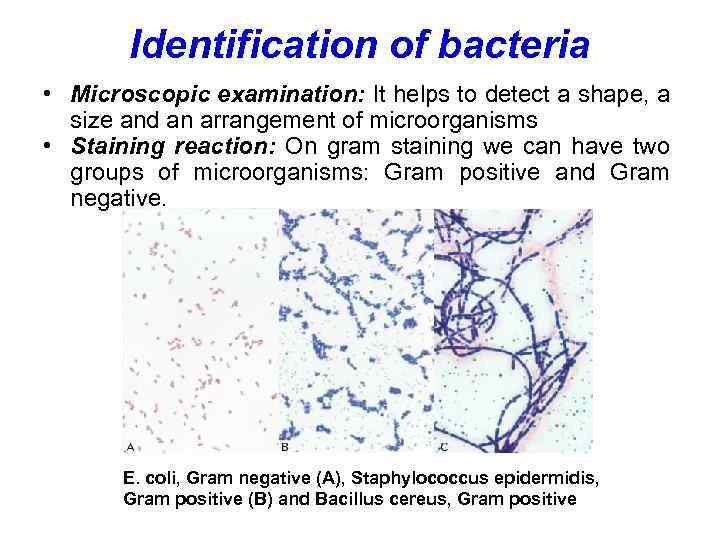 Identification of bacteria • Microscopic examination: It helps to detect a shape, a size