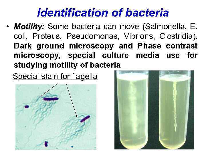 Identification of bacteria • Motility: Some bacteria can move (Salmonella, E. coli, Proteus, Pseudomonas,