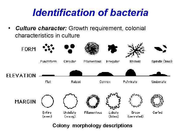 Identification of bacteria • Culture character: Growth requirement, colonial characteristics in culture Colony morphology