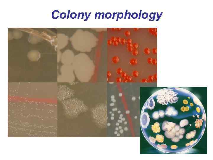 Colony morphology 