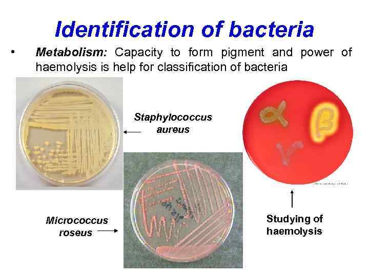 Identification of bacteria • Metabolism: Capacity to form pigment and power of haemolysis is