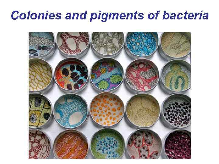 Colonies and pigments of bacteria 