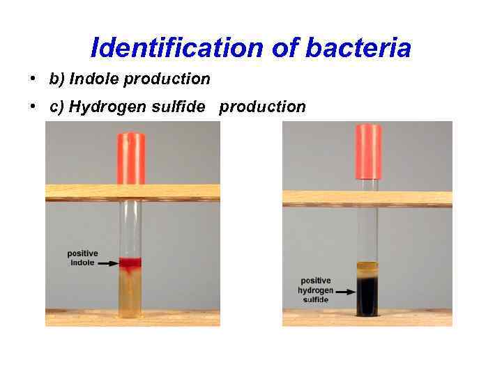 Identification of bacteria • b) Indole production • c) Hydrogen sulfide production 