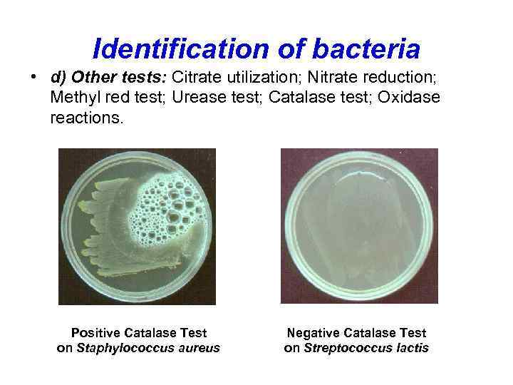 Identification of bacteria • d) Other tests: Citrate utilization; Nitrate reduction; Methyl red test;