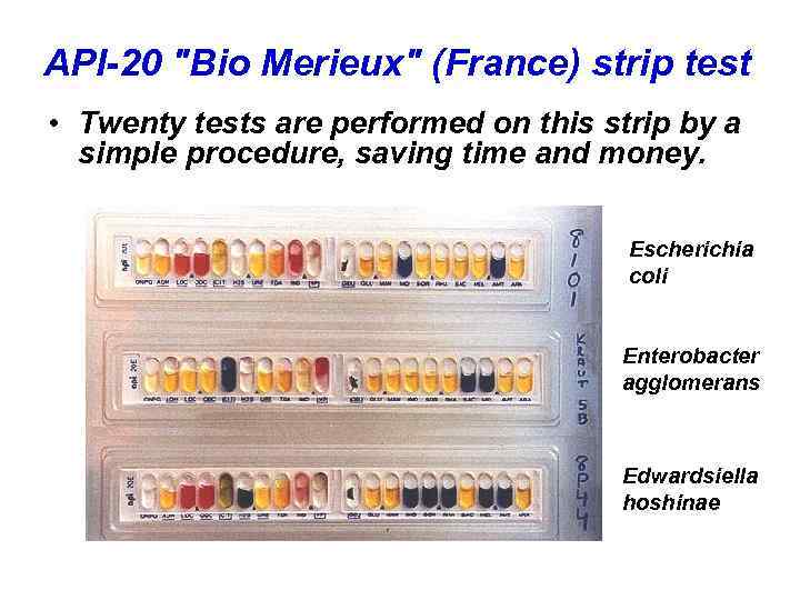 API-20 "Bio Merieux" (France) strip test • Twenty tests are performed on this strip