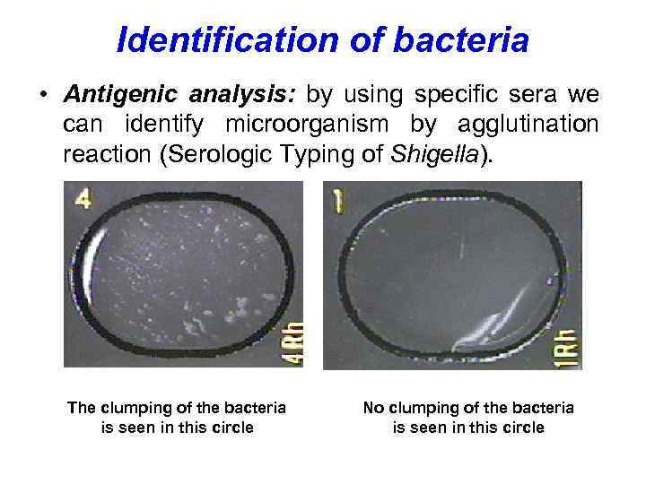 Identification of bacteria • Antigenic analysis: by using specific sera we can identify microorganism