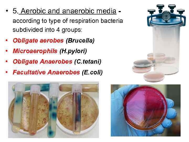  • 5. Aerobic and anaerobic media according to type of respiration bacteria subdivided