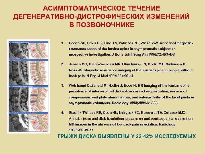 АСИМПТОМАТИЧЕСКОЕ ТЕЧЕНИЕ ДЕГЕНЕРАТИВНО-ДИСТРОФИЧЕСКИХ ИЗМЕНЕНИЙ В ПОЗВОНОЧНИКЕ 1. Boden SD, Davis DO, Dina TS, Patronas