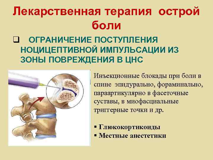 Лекарственная терапия острой боли q ОГРАНИЧЕНИЕ ПОСТУПЛЕНИЯ НОЦИЦЕПТИВНОЙ ИМПУЛЬСАЦИИ ИЗ ЗОНЫ ПОВРЕЖДЕНИЯ В ЦНС
