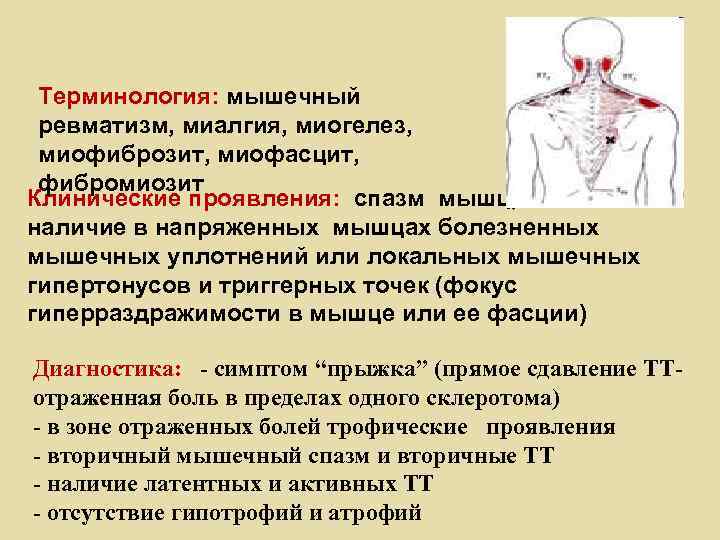 Терминология: мышечный ревматизм, миалгия, миогелез, миофиброзит, миофасцит, фибромиозит Клинические проявления: спазм мышц, наличие в