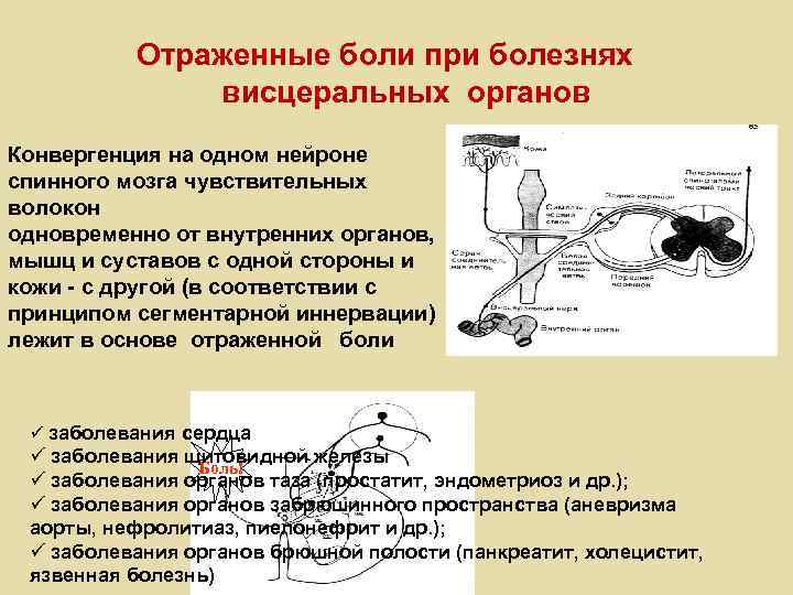 Отраженные боли при болезнях висцеральных органов Конвергенция на одном нейроне спинного мозга чувствительных волокон