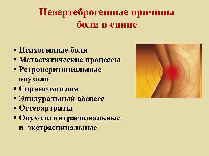 Невертеброгенные причины боли в спине § Психогенные боли § Метастатические процессы § Ретроперитонеальные опухоли
