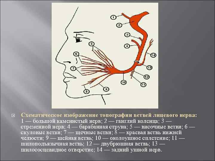  Схематическое изображение топографии ветвей лицевого нерва: 1 — большой каменистый нерв; 2 —
