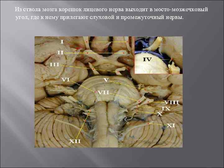  Из ствола мозга корешок лицевого нерва выходит в мосто-мозжечковый угол, где к нему