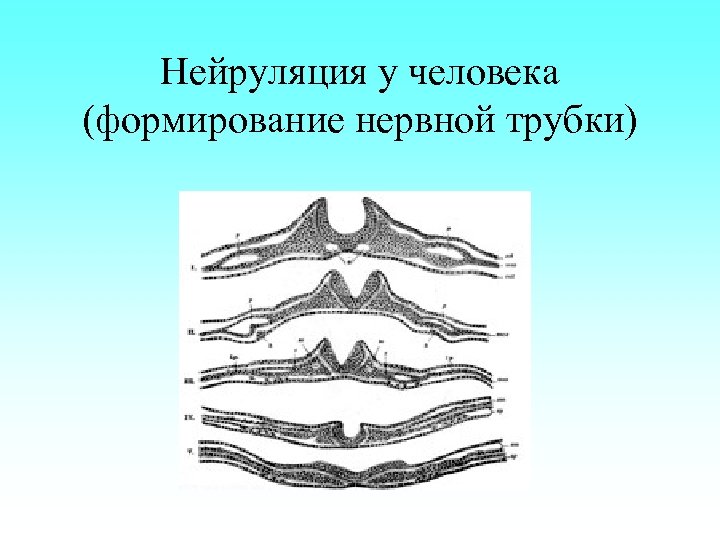 Нейруляция у человека (формирование нервной трубки) 