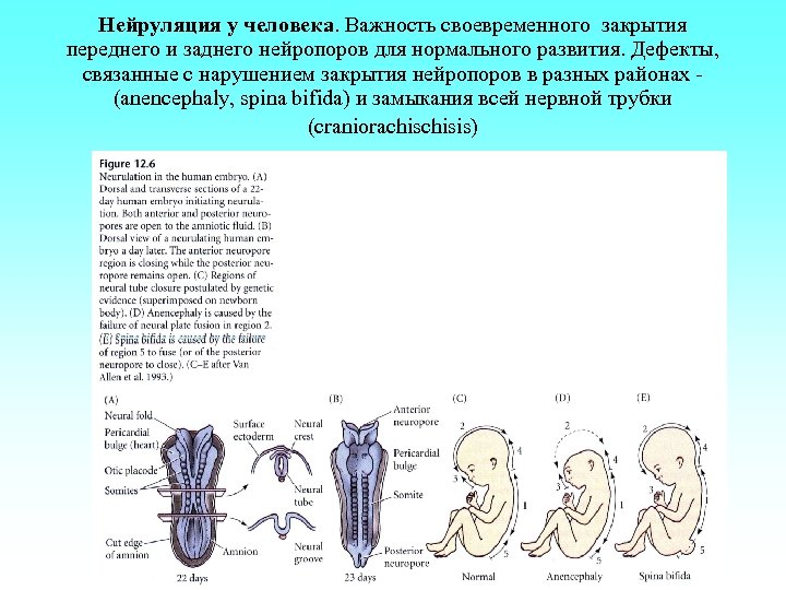 Нейруляция у человека. Важность своевременного закрытия переднего и заднего нейропоров для нормального развития. Дефекты,