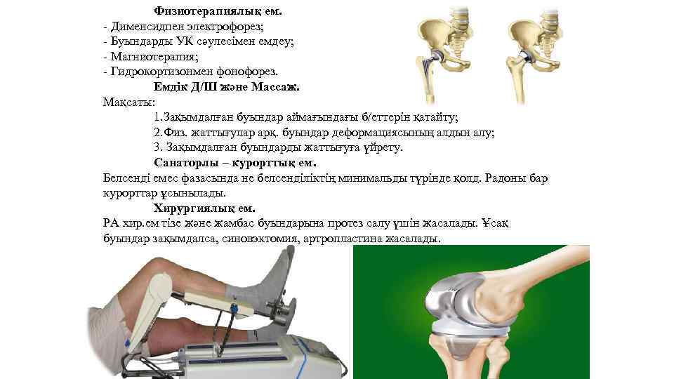 Физиотерапиялық ем. - Дименсидпен электрофорез; - Буындарды УК сәулесімен емдеу; - Магниотерапия; - Гидрокортизонмен