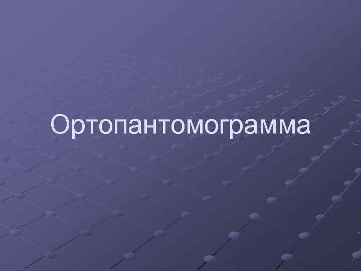 Ортопантомограмма 