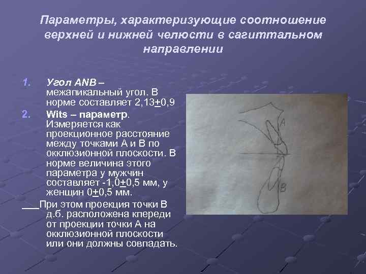 Параметры, характеризующие соотношение верхней и нижней челюсти в сагиттальном направлении 1. Угол ANB –