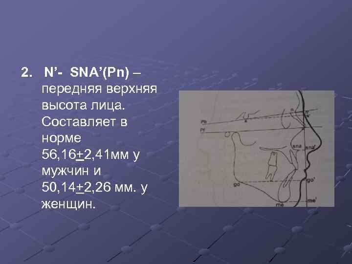 2. N’- SNA’(Pn) – передняя верхняя высота лица. Составляет в норме 56, 16+2, 41