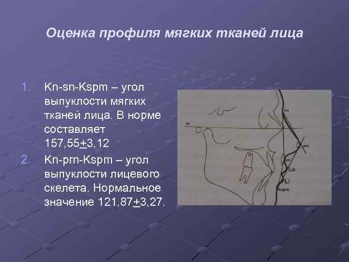 Оценка профиля мягких тканей лица 1. 2. Kn-sn-Kspm – угол выпуклости мягких тканей лица.