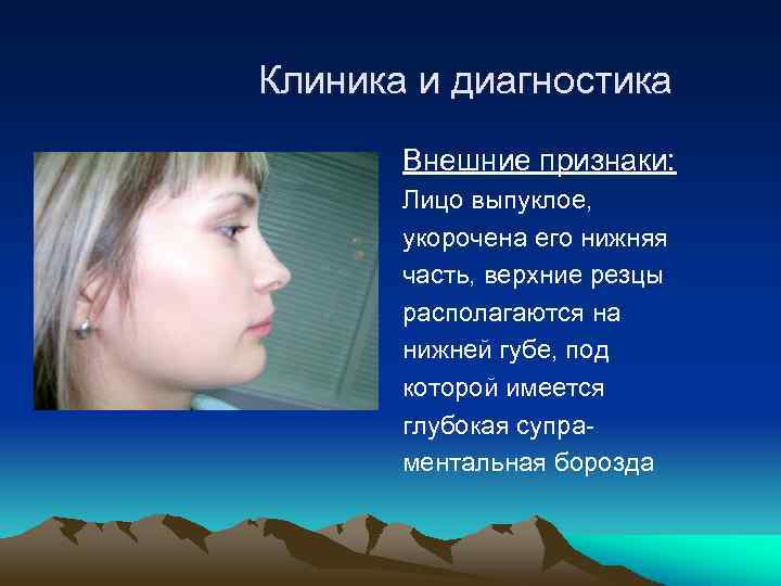  Клиника и диагностика Внешние признаки: Лицо выпуклое, укорочена его нижняя часть, верхние резцы
