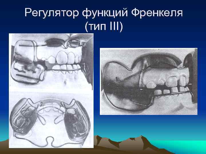 Регулятор функций Френкеля (тип III) 