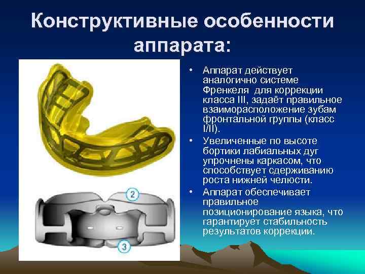 Конструктивные особенности аппарата: • Аппарат действует аналогично системе Френкеля для коррекции класса III, задаёт