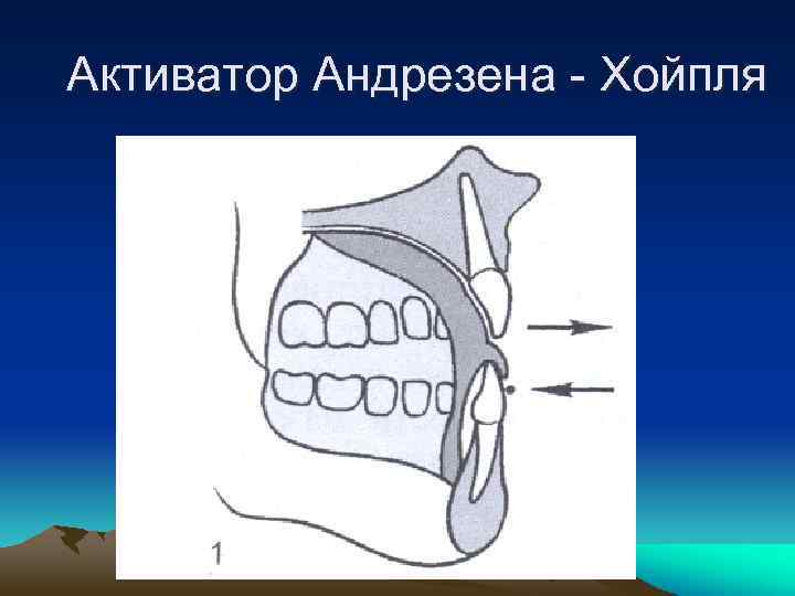 Активатор Андрезена - Хойпля 