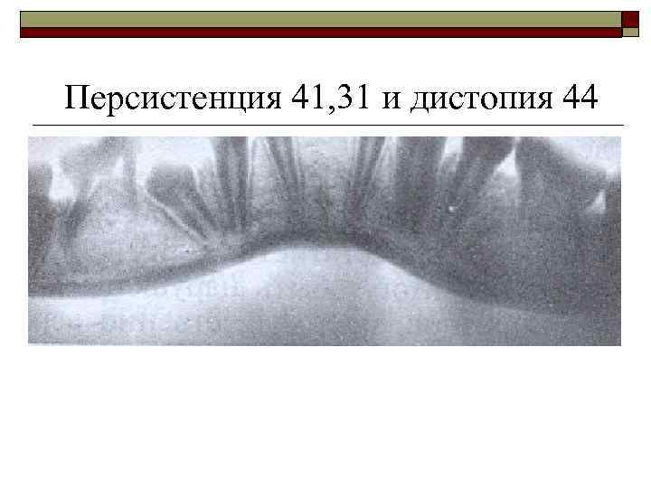 Персистенция 41, 31 и дистопия 44 