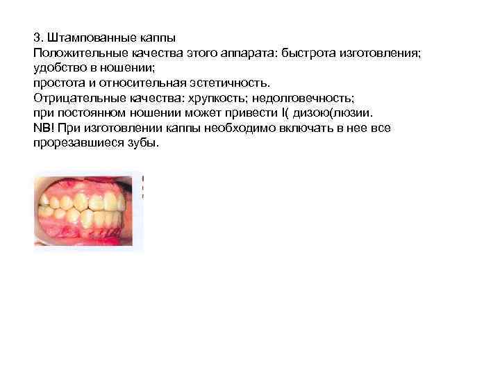 3. Штампованные каппы Положительные качества этого аппарата: быстрота изготовления; удобство в ношении; простота и