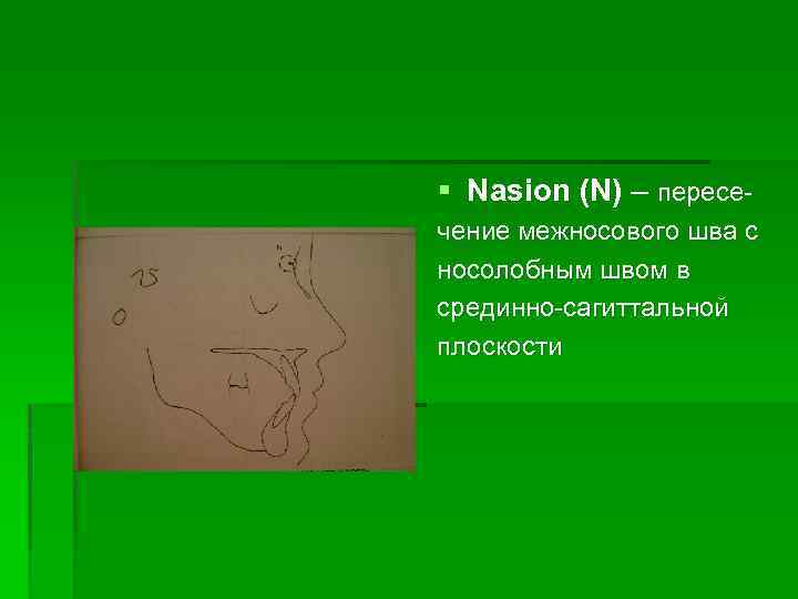 § Nasion (N) – пересечение межносового шва с носолобным швом в срединно-сагиттальной плоскости 