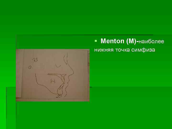 § Menton (M)-наиболее нижняя точка симфиза 