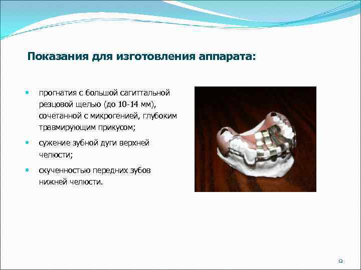 Показания для изготовления аппарата: прогнатия с большой сагиттальной резцовой щелью (до 10 -14 мм),