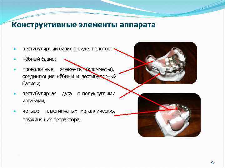 Конструктивные элементы аппарата • вестибулярный базис в виде пелотов; • нёбный базис; • проволочные