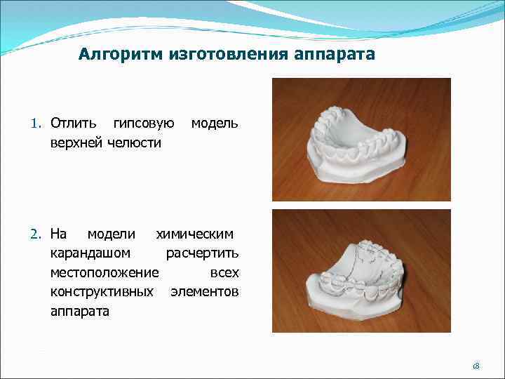 Алгоритм изготовления аппарата 1. Отлить гипсовую верхней челюсти модель 2. На модели химическим карандашом