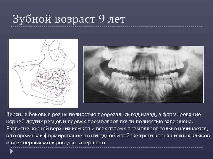 Зубной возраст. Формирование корней верхних резцов. Возраст зубов.