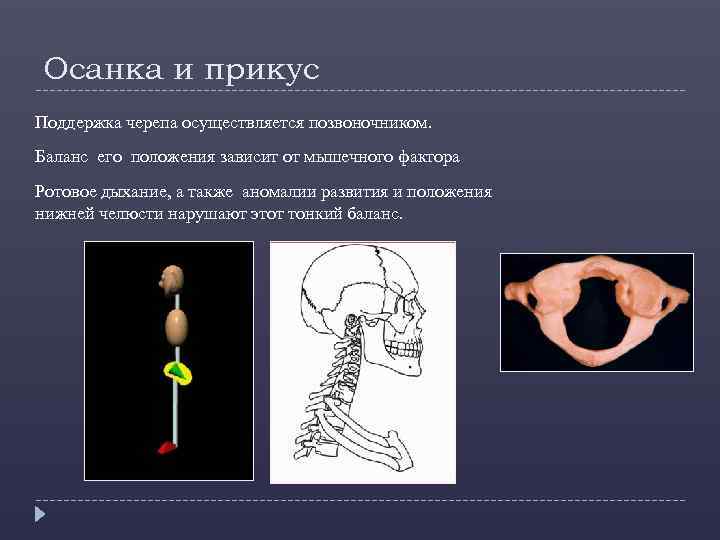 Осанка и прикус Поддержка черепа осуществляется позвоночником. Баланс его положения зависит от мышечного фактора
